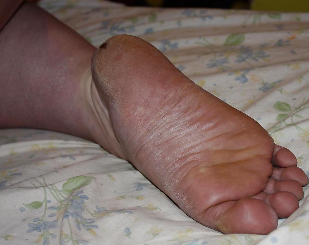 25P Mature feet !