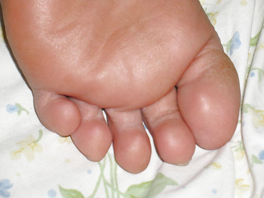 25P Mature feet !