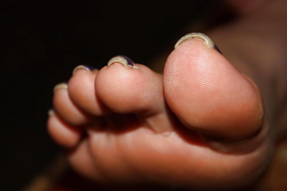 25P Mature feet !