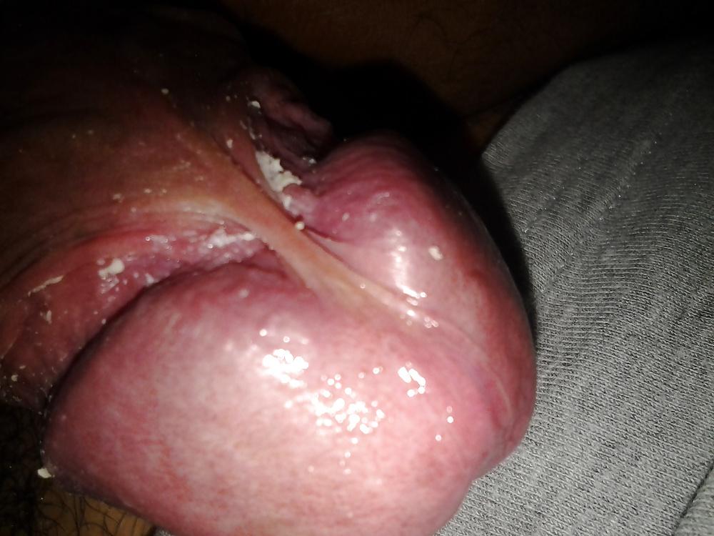 14P More uncut cheesy smegma smelly cock