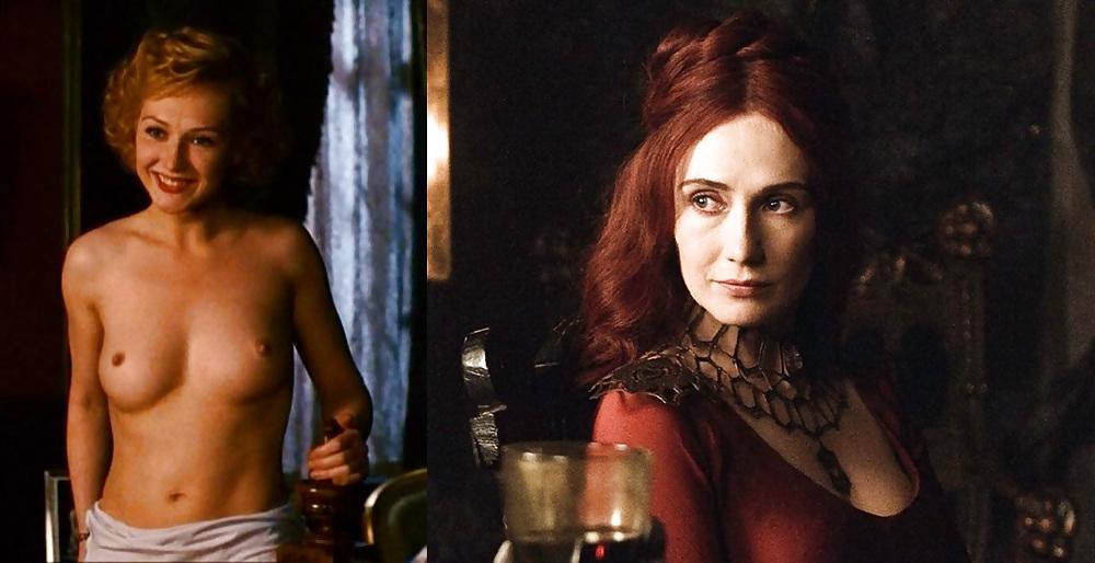 8P Dressed and Undressed Celebrities pt6(Game of Thrones)