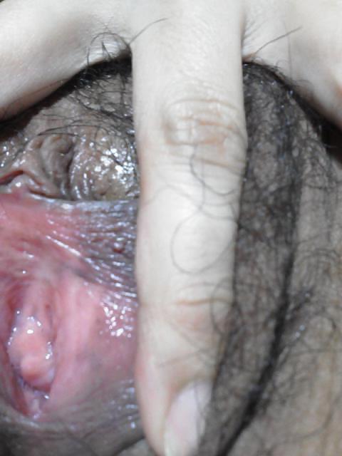 4P Both holes