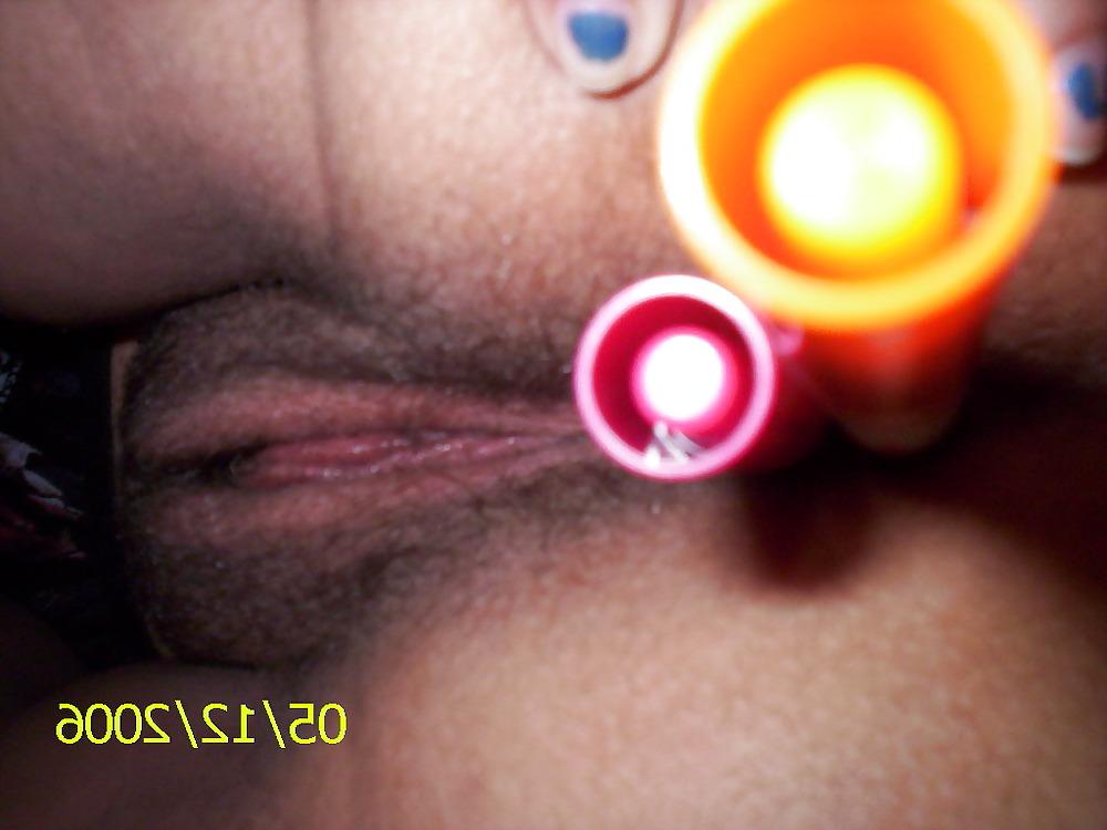 5P Marker anal sex
