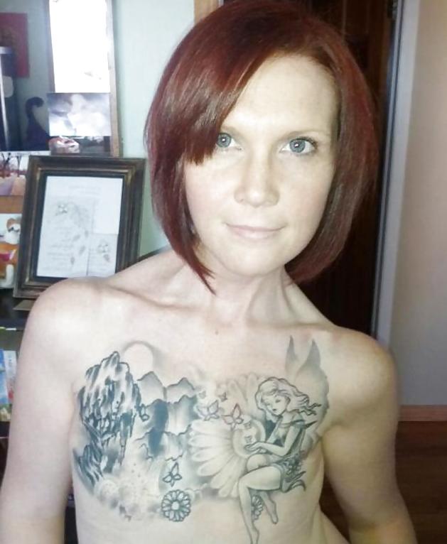25P Amputee Mastectomy Handicapped