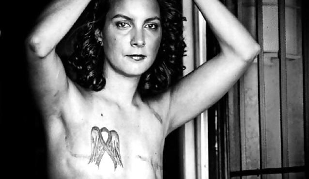 25P Amputee Mastectomy Handicapped