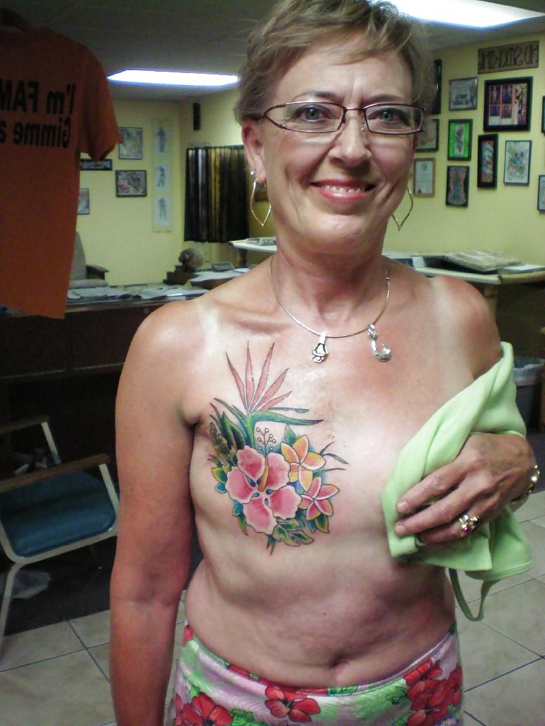 25P Amputee Mastectomy Handicapped