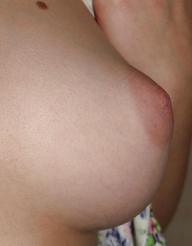 15P Erotic Sexy girls boobs large and puffy nipples teens 6
