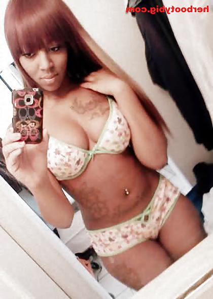 25P Woman Diagnosed With Ghetto Booty