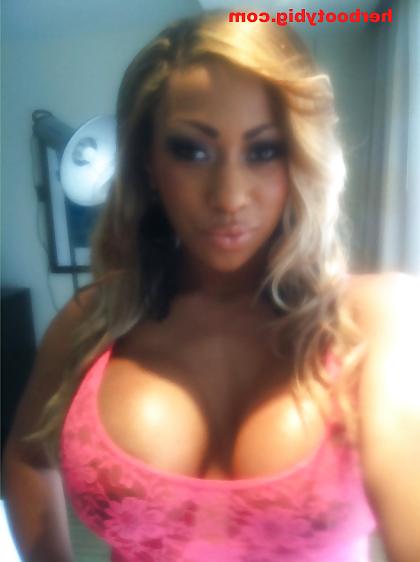 25P Woman Diagnosed With Ghetto Booty