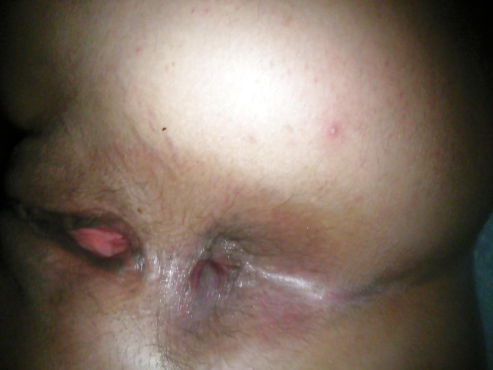 25P Mature anal