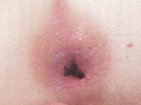 25P Distra Ass Master #1