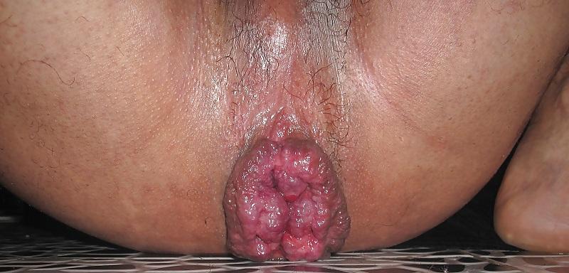 10P Gapeng anal hole