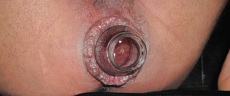 10P Gapeng anal hole