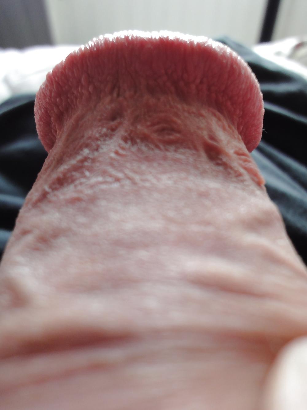 25P HD closeup of my pierced circumcised penis