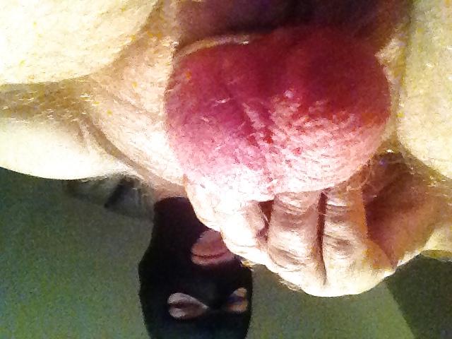13P Ball stretching and torture 