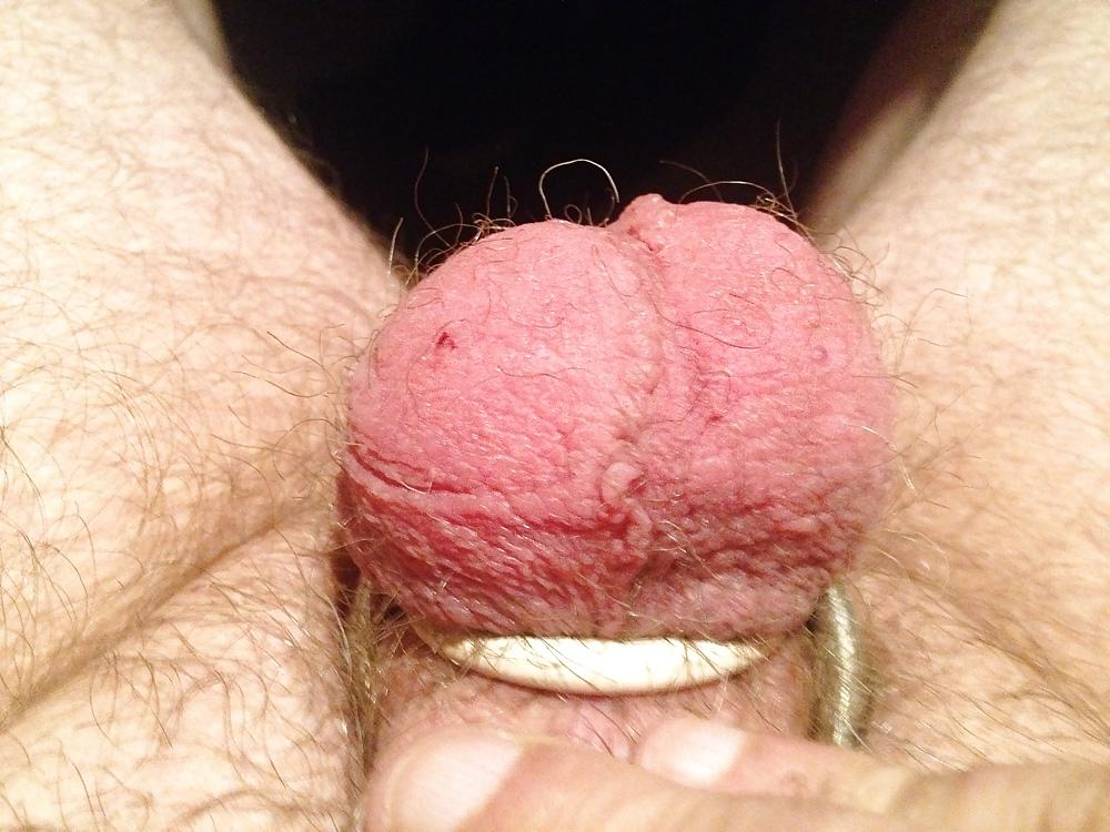 13P Ball stretching and torture 
