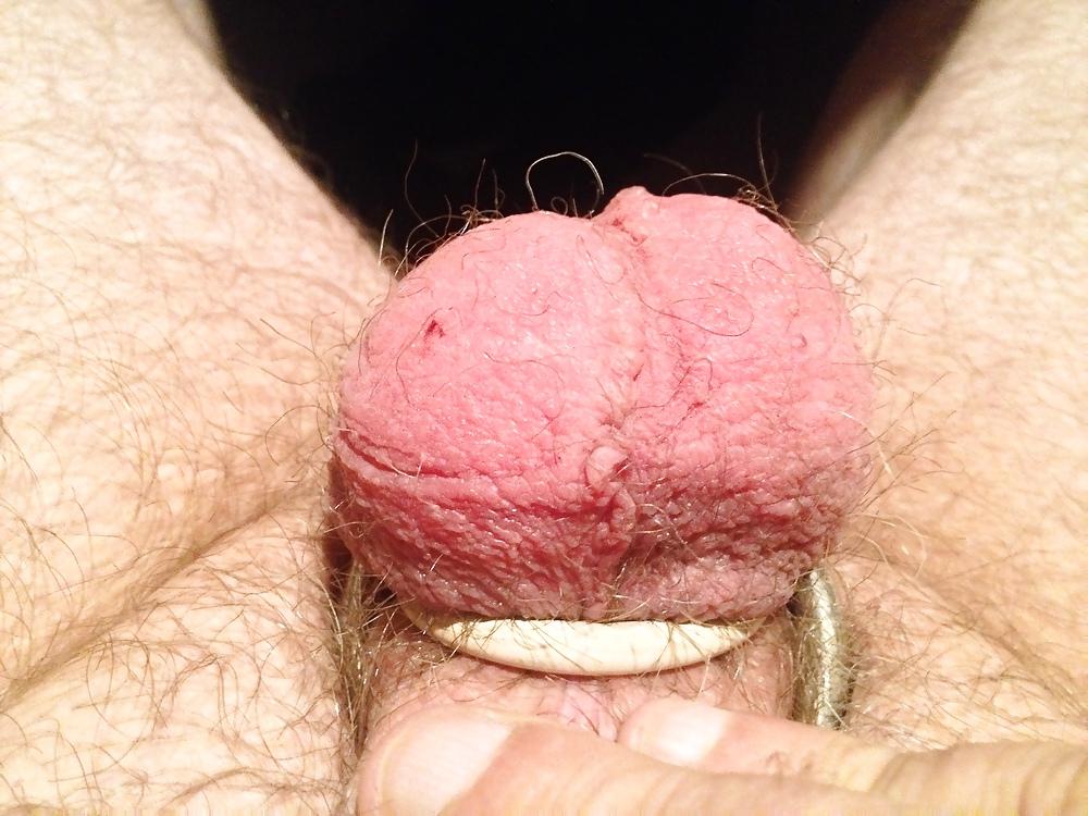 13P Ball stretching and torture 