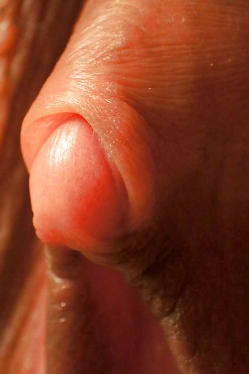 25P Big clit