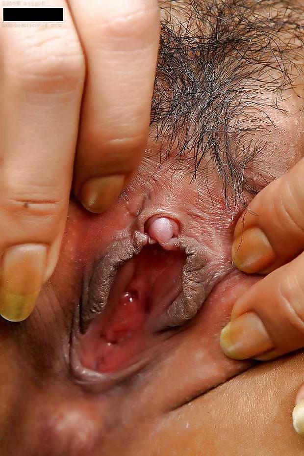 25P Big clit