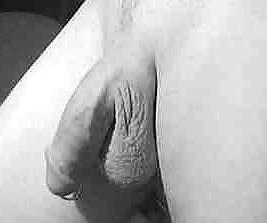 25P The Pierced one