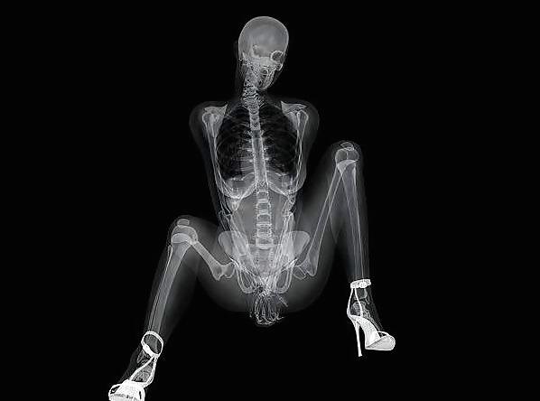 12P Erotic XRays