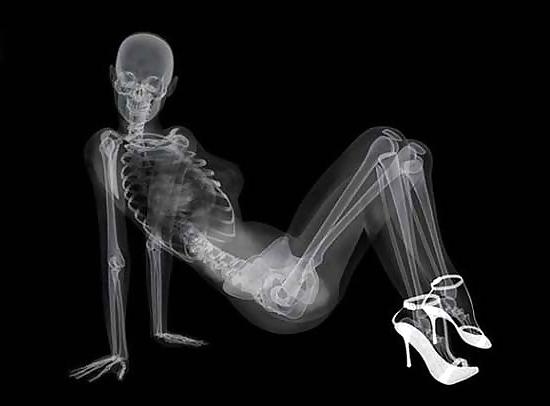 12P Erotic XRays