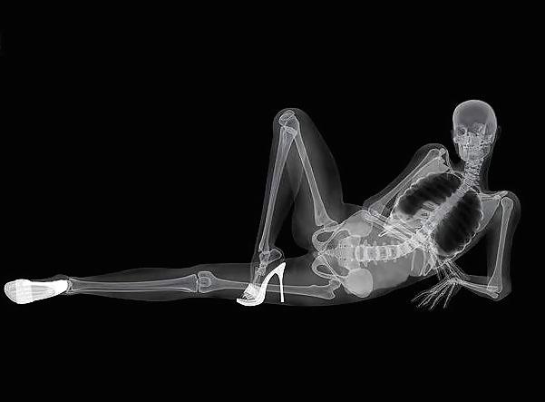 12P Erotic XRays