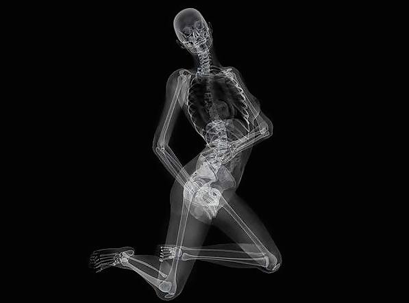 12P Erotic XRays