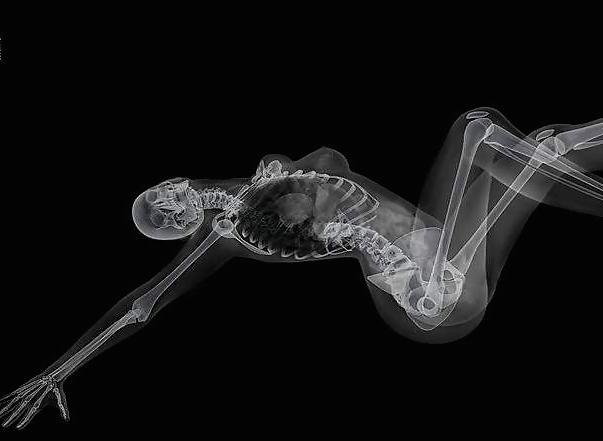 12P Erotic XRays