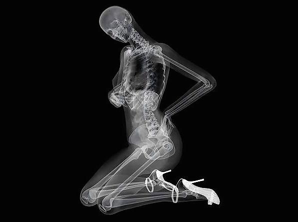 12P Erotic XRays