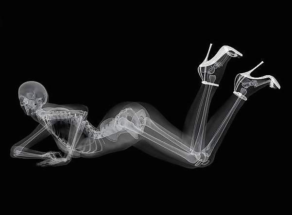 12P Erotic XRays