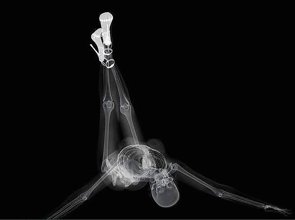 12P Erotic XRays