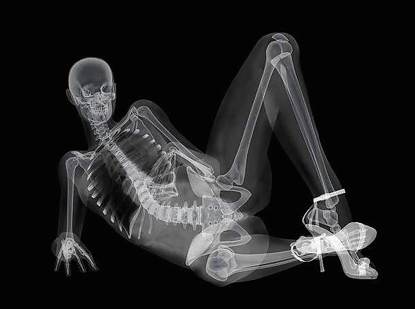 12P Erotic XRays