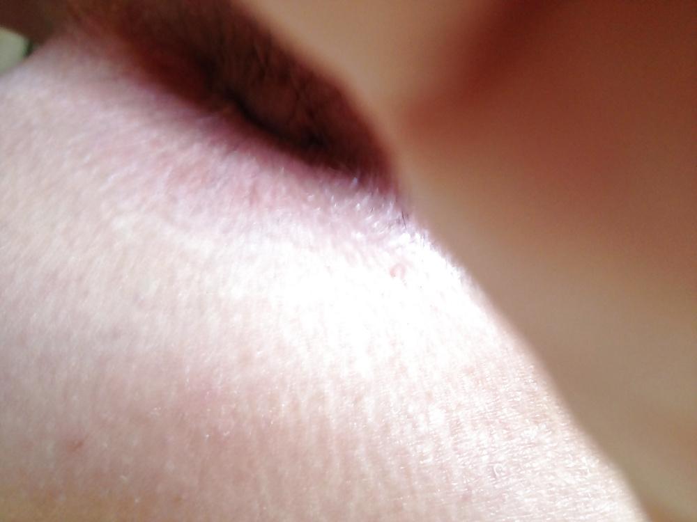 9P Ich