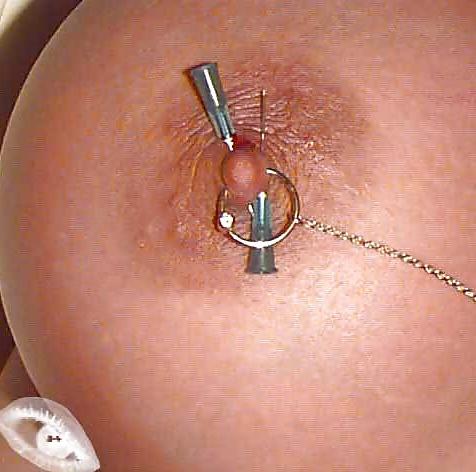 22P Pierced And Pinched
