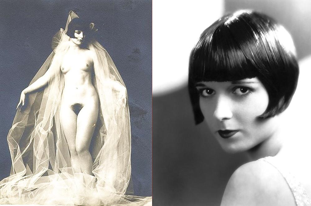 20P Celebs Dressed-Undressed