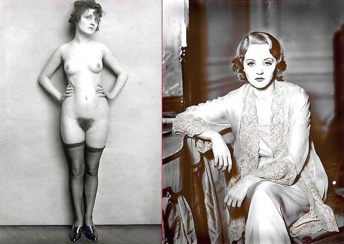 20P Celebs Dressed-Undressed