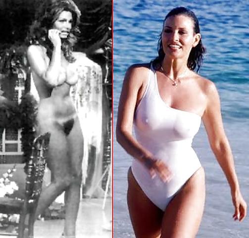 20P Celebs Dressed-Undressed