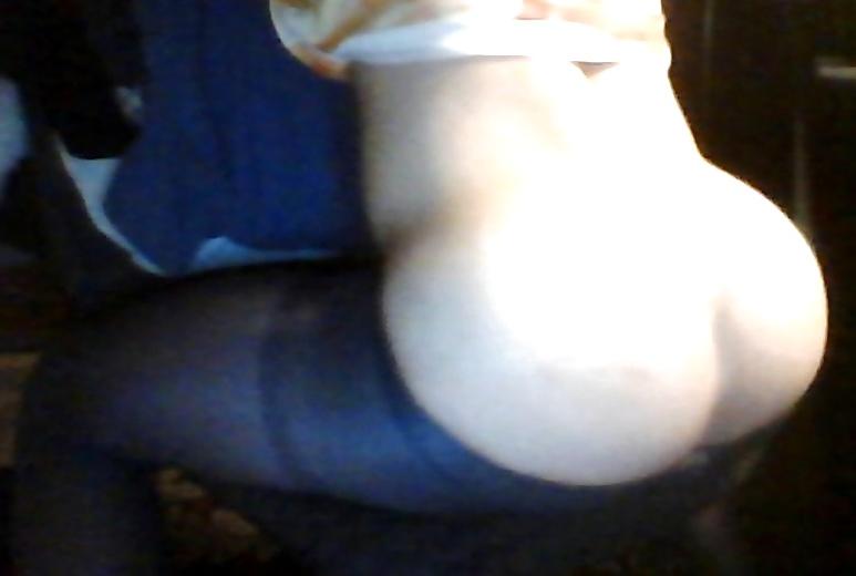 9P Trap Anal Gaping