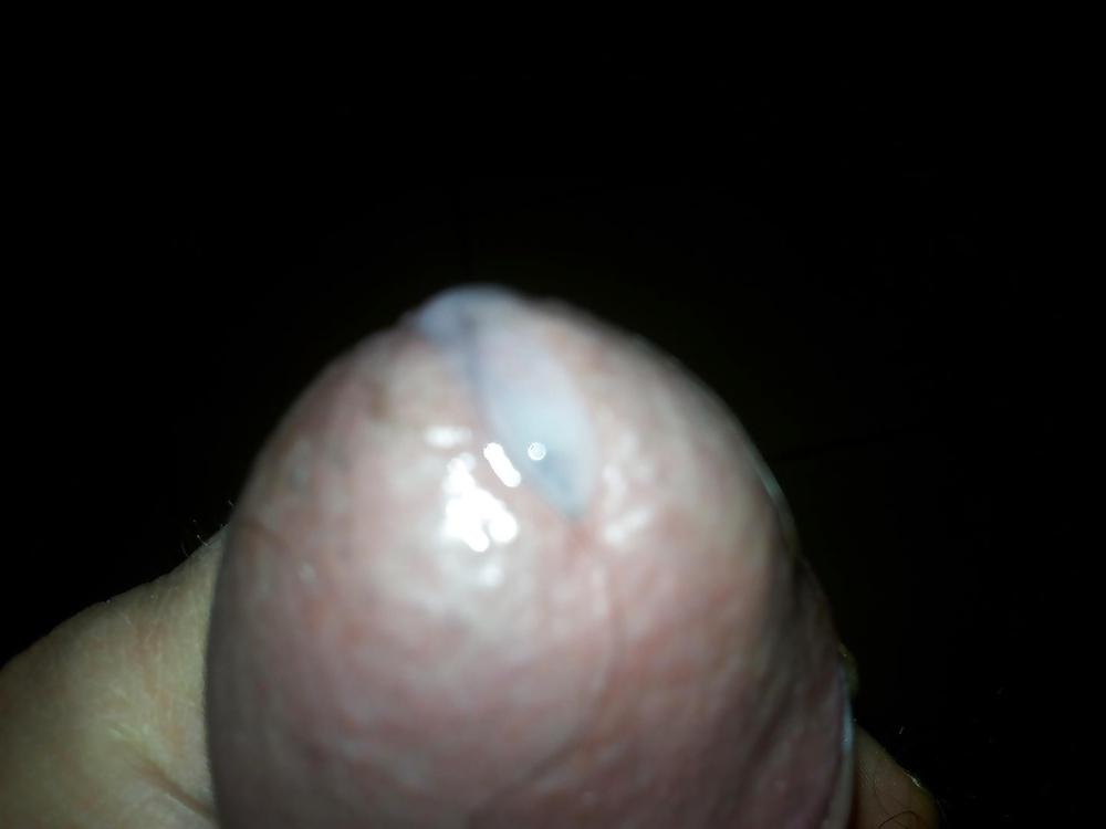 8P SBORRATA SOLITARIA