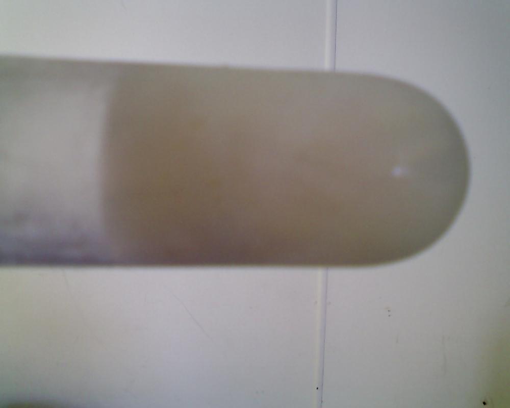 17P Speculum and Frozen cum