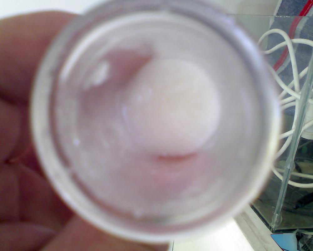 17P Speculum and Frozen cum
