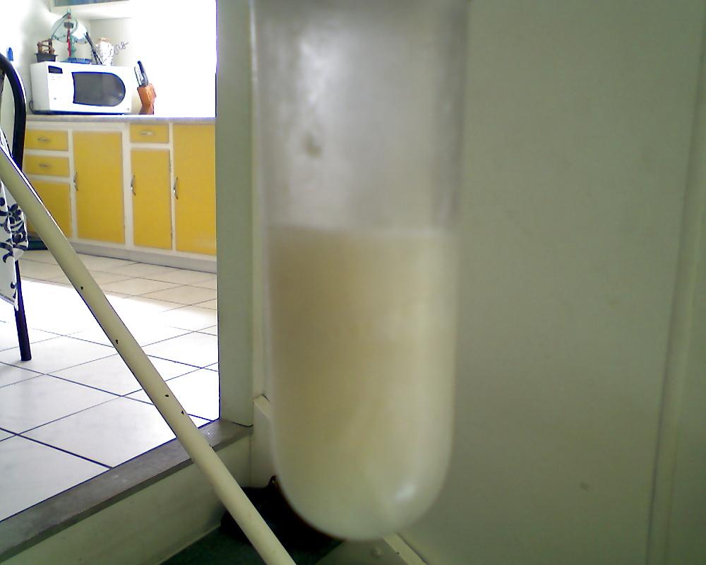 17P Speculum and Frozen cum