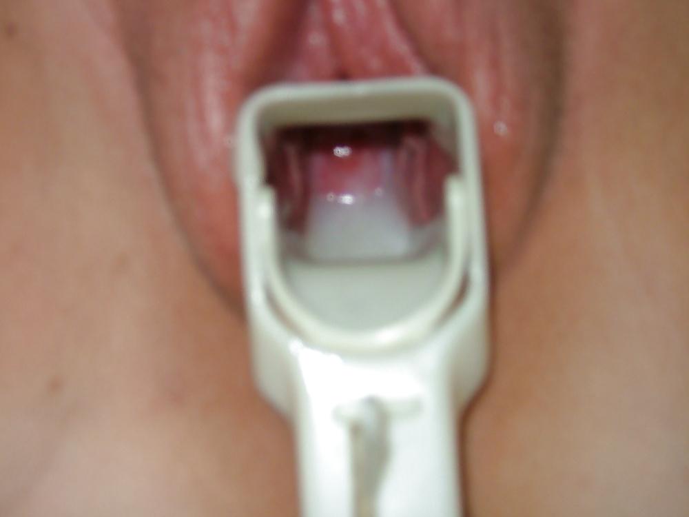 17P Speculum and Frozen cum