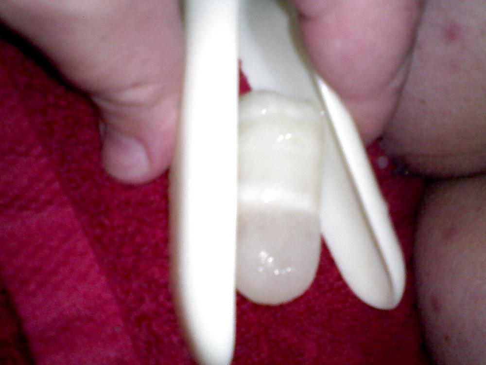 17P Speculum and Frozen cum