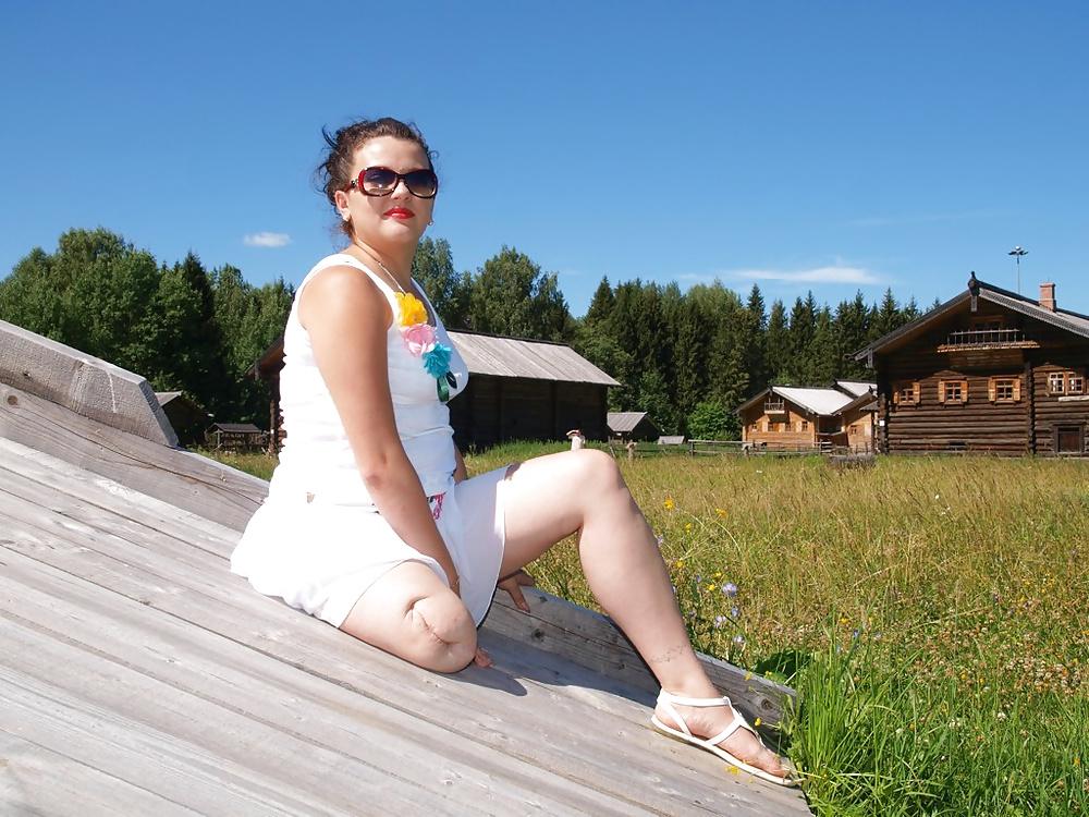 8P Amputee and mastectomy girls