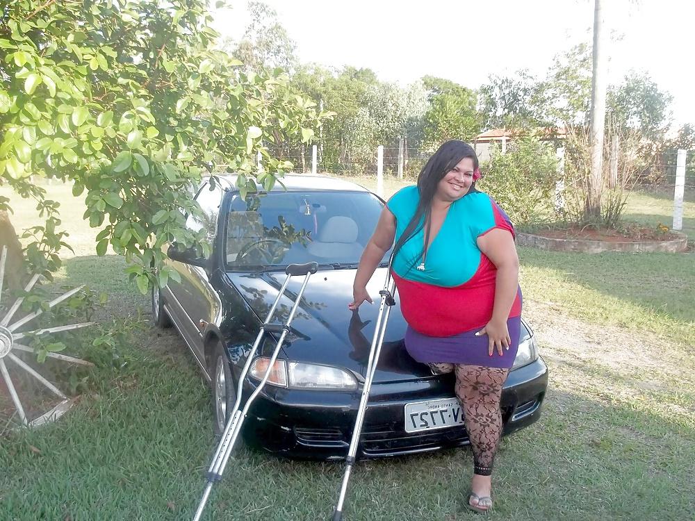 20P Amputee girls are also sexy