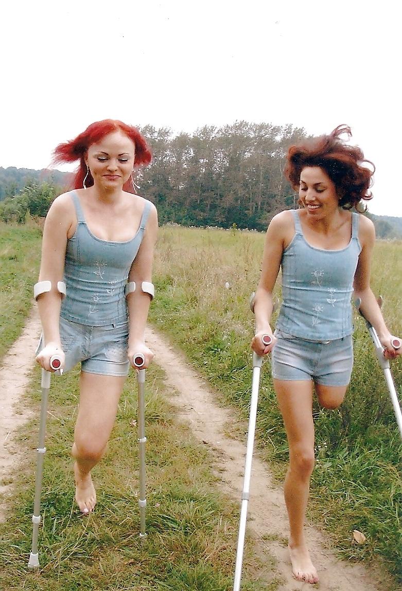 25P Amputee girls can be still sexy