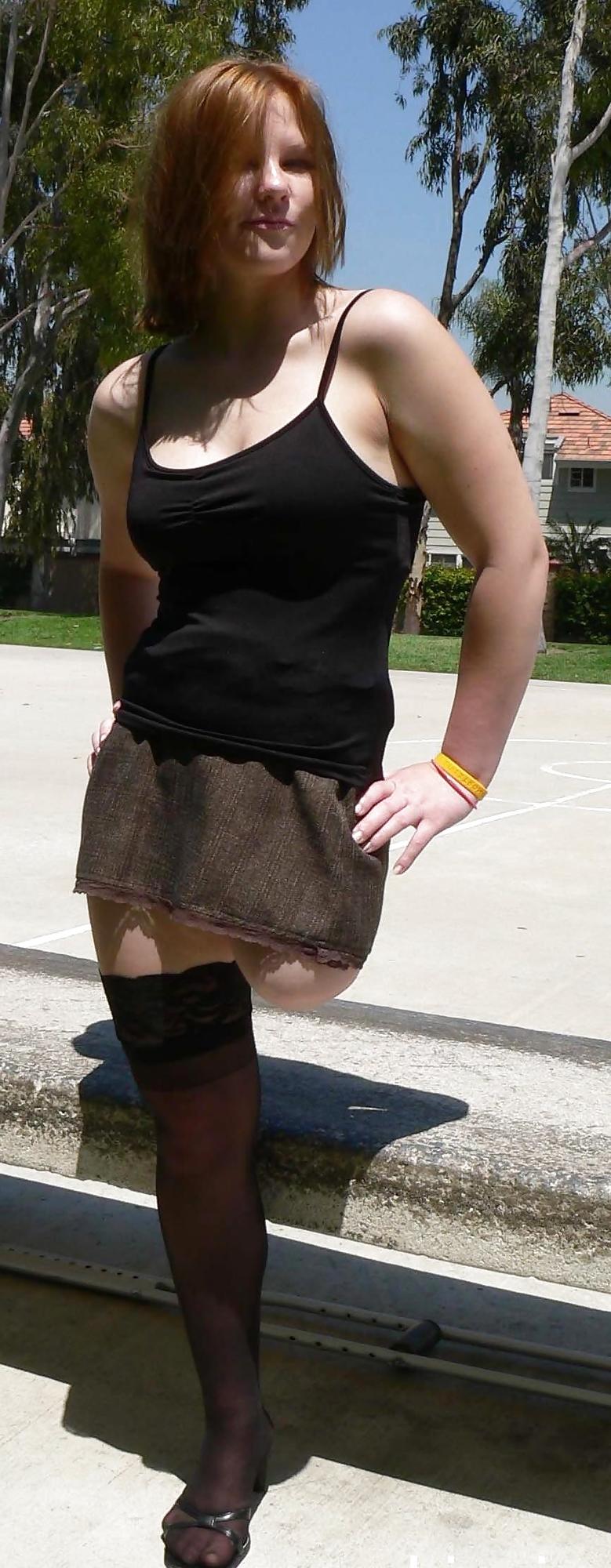 25P Amputee girls can be still sexy