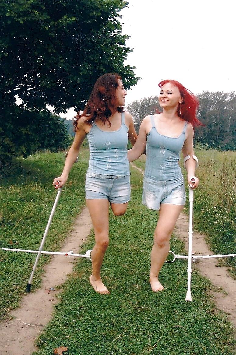 25P Amputee girls can be still sexy